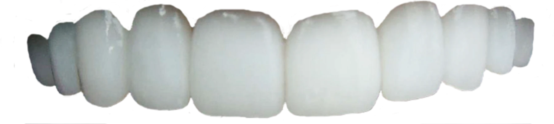 Upper teeth