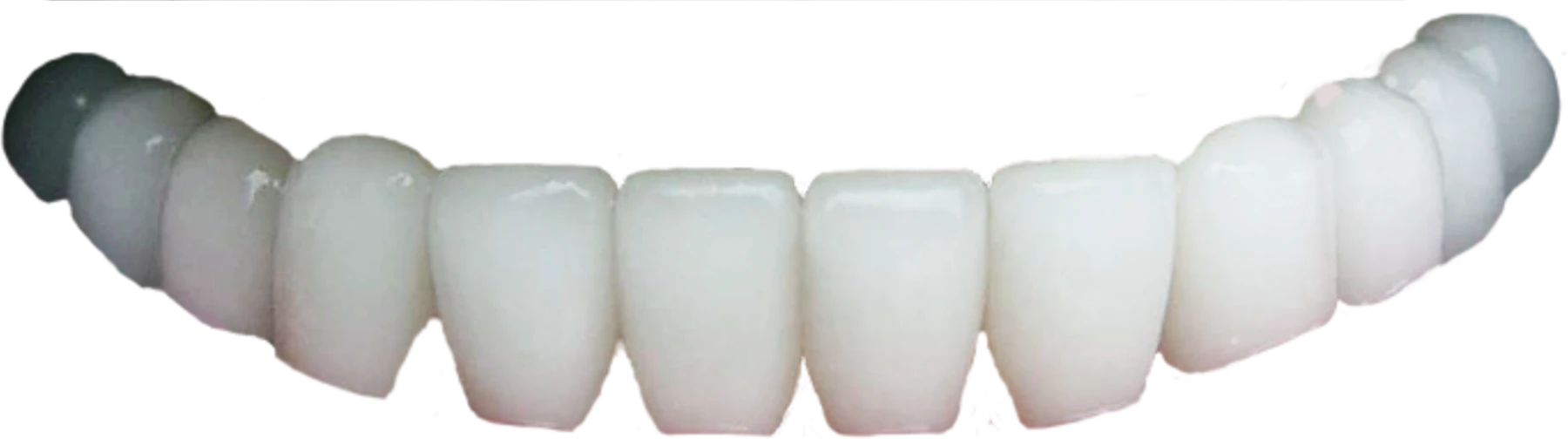Lower teeth